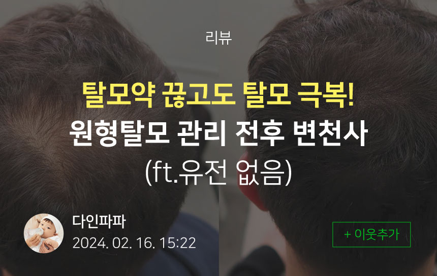 탈젠샴푸 효능가격