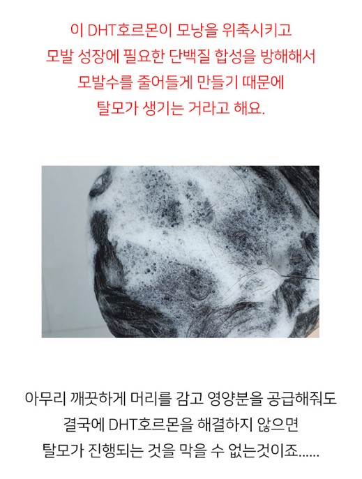 탈젠 플러스 샴푸